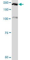 PLXNA2 / Plexin A2 Antibody (clone 2G5)