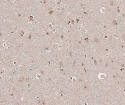 Polyclonal Rabbit anti-Human TRADD Antibody (IHC, IF, WB)