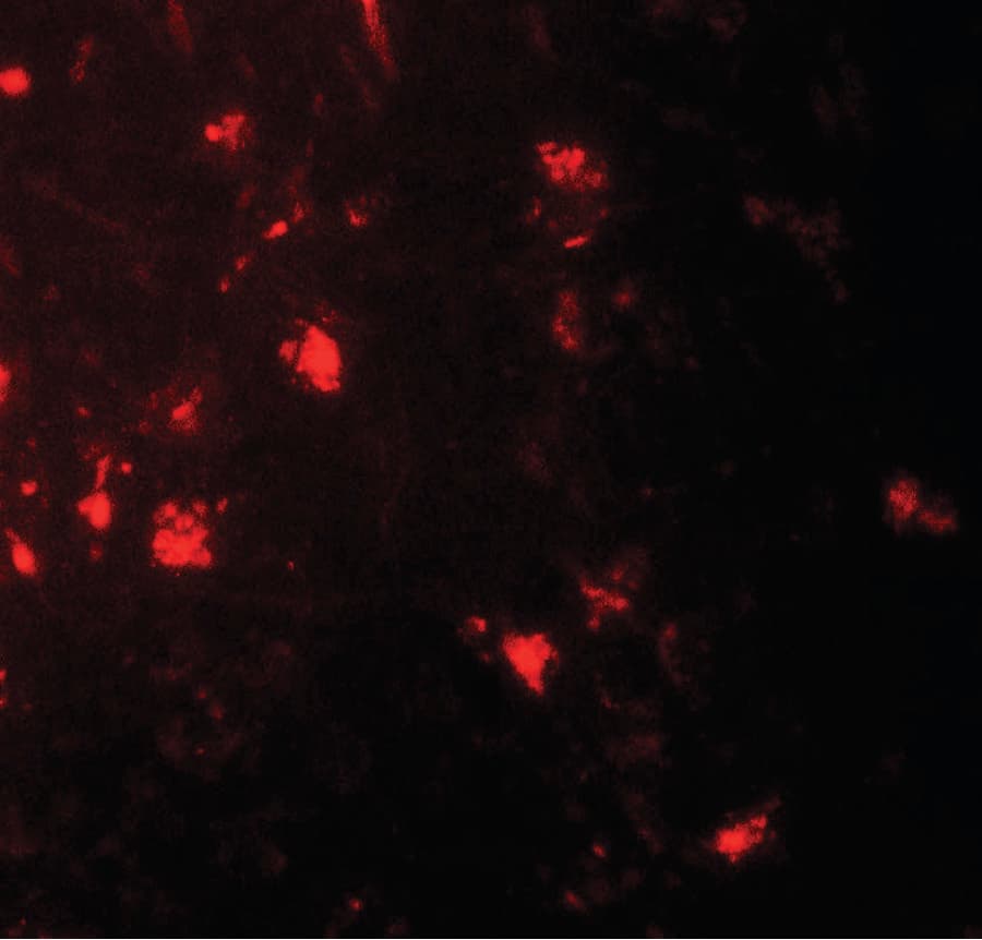 IL36A Antibody