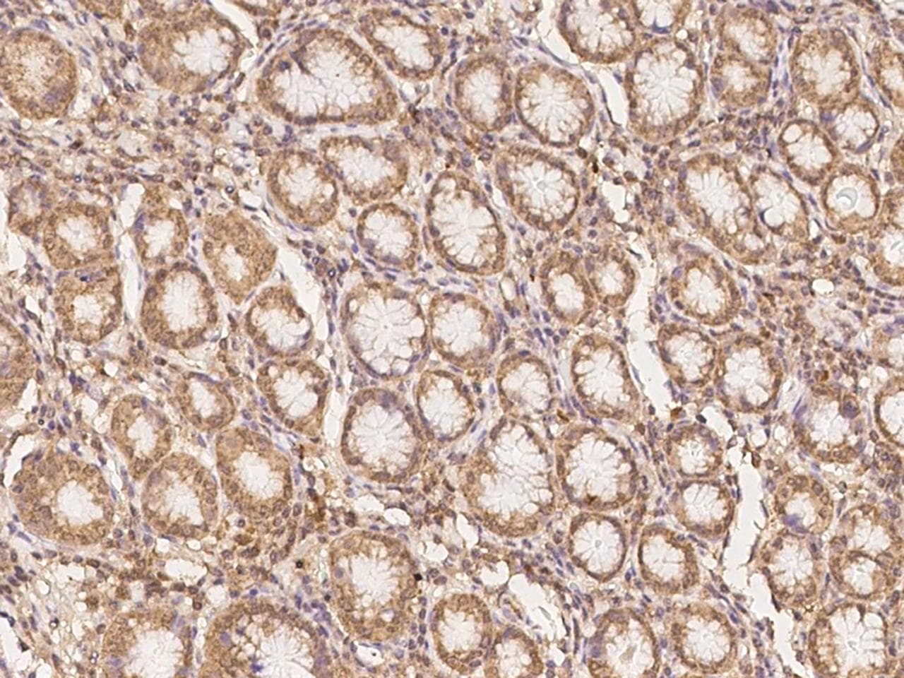 CLN6 Antibody