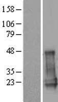 CGGBP1 Protein (Over-Expression Lysate Myc-DDK (Flag))