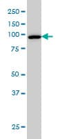 Monoclonal Mouse anti-Human CSE1L Antibody (clone 3D8, IF, WB)