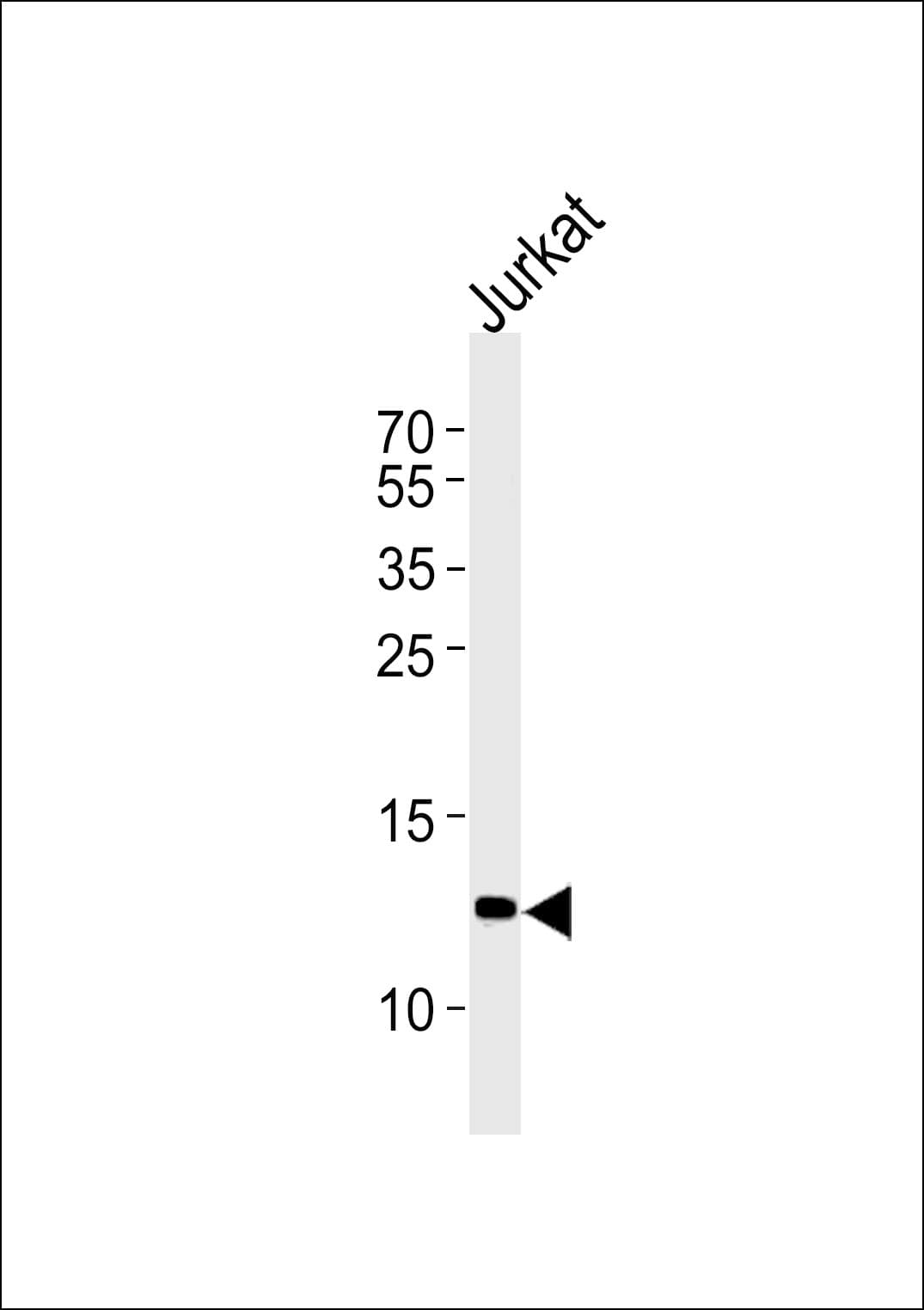 Polyclonal Rabbit anti-Human B2M / Beta 2 Microglobulin Antibody (aa86-118, IHC, WB)