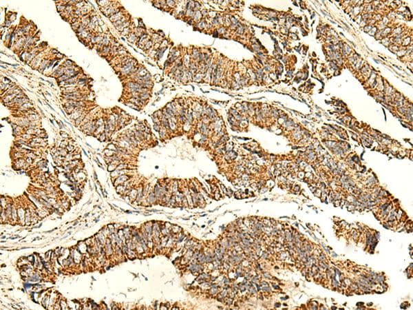 Polyclonal Rabbit anti-Human ATP5H Antibody (IHC, WB)
