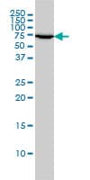 IHC-plus™ XRCC6 / Ku70 Antibody (clone 4C2-1A6)