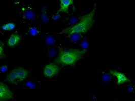 Basigin / Emmprin / CD147 Antibody (clone OTI3E9)
