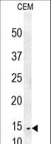 Polyclonal Rabbit anti-Human C1orf42 / NICE-1 Antibody (aa1-30, IHC, WB)