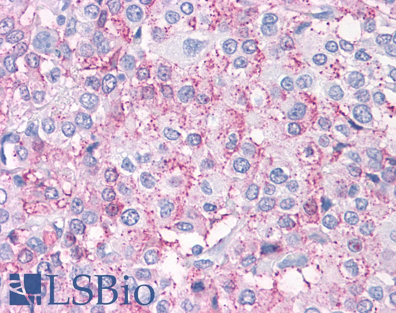 PathPlus™ PKD3 / PRKD3 Antibody (Internal)
