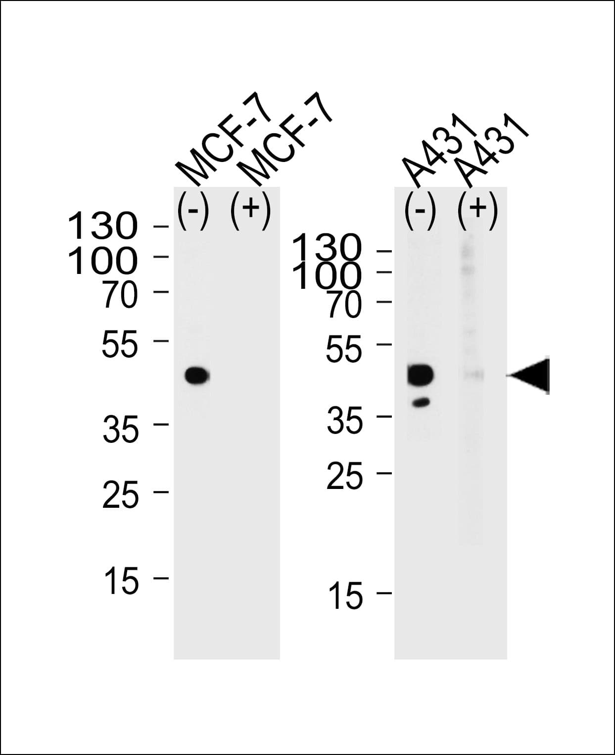 IHC-plus™ CALCR / Calcitonin Receptor Antibody (aa445-474)