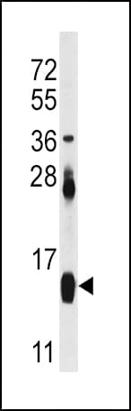 IHC-plus™ FABP4 / AP2 Antibody (Tyr20)
