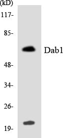 DAB1 Antibody (aa165-214)