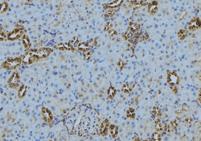 Polyclonal Rabbit anti-Human CAMSAP2 Antibody (IHC, IF, WB)