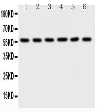 AKT2 Antibody (aa454-481)