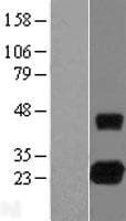 Human TCL / RHOJ Protein (Over-Expression Lysate Myc-DDK (Flag))