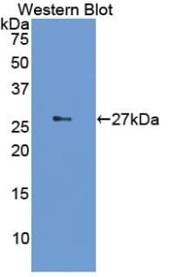 IL2RA / CD25 Antibody (aa24-225, Biotin)