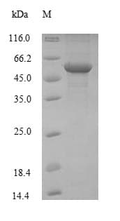 Mouse ENO1 / Alpha Enolase Protein (Recombinant 10His, N-terminus)