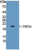 Polyclonal Rabbit anti-Human His Tag Antibody (PE, WB)