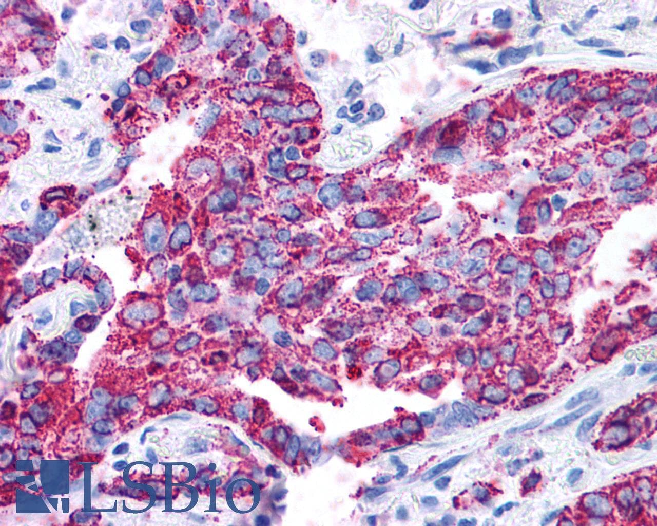 PathPlus™ Polyclonal Rabbit anti-Human VPAC2 / VIPR2 Antibody (C-Terminus, IHC)