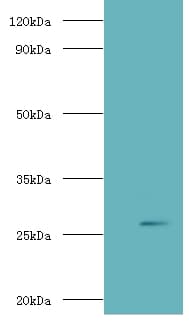 Adiponectin Antibody