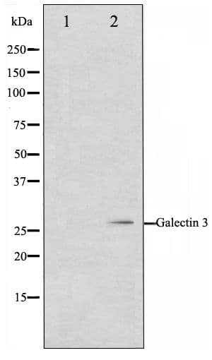 LGALS3 / Galectin 3 Antibody