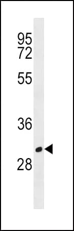 Polyclonal Rabbit anti-Human CD20 Antibody (aa216-244, WB)