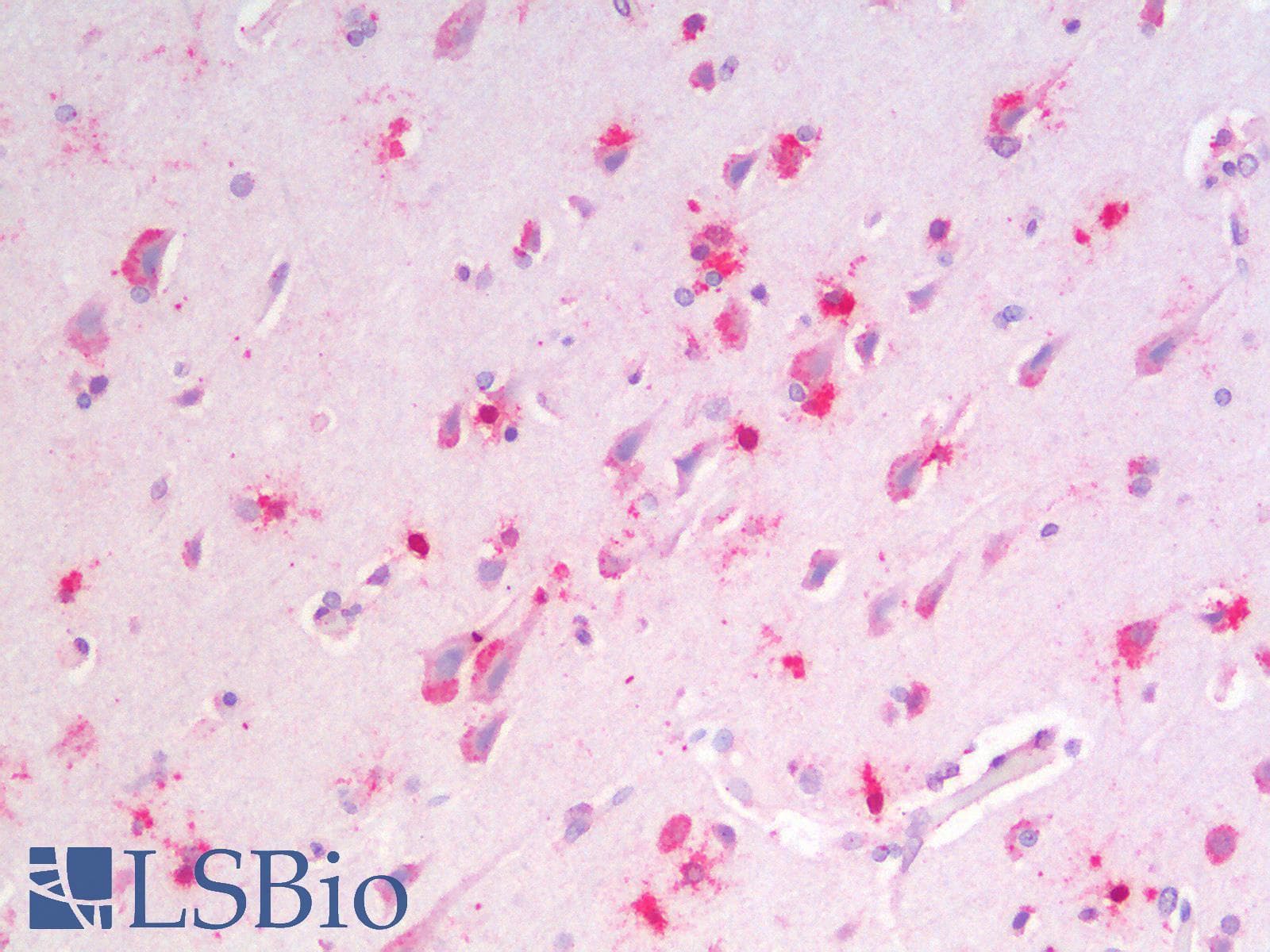 IHC-plus™ Polyclonal Goat anti-Human MSI2 Antibody (N Terminus, IHC, WB)