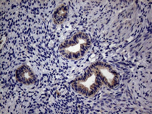 Monoclonal Mouse anti-Human TRIP13 Antibody (clone OTI2F5, aa31-148, IHC, WB)