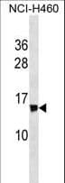 Polyclonal Rabbit anti-Human NDUFS6 Antibody (aa28-56, WB)