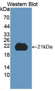 ITGB8 / Integrin Beta 8 Antibody (aa471-629, Cy3)