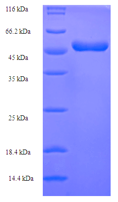 Marburg Virus Matrix Protein VP40 (Recombinant 6His-SUMO, N-terminus)