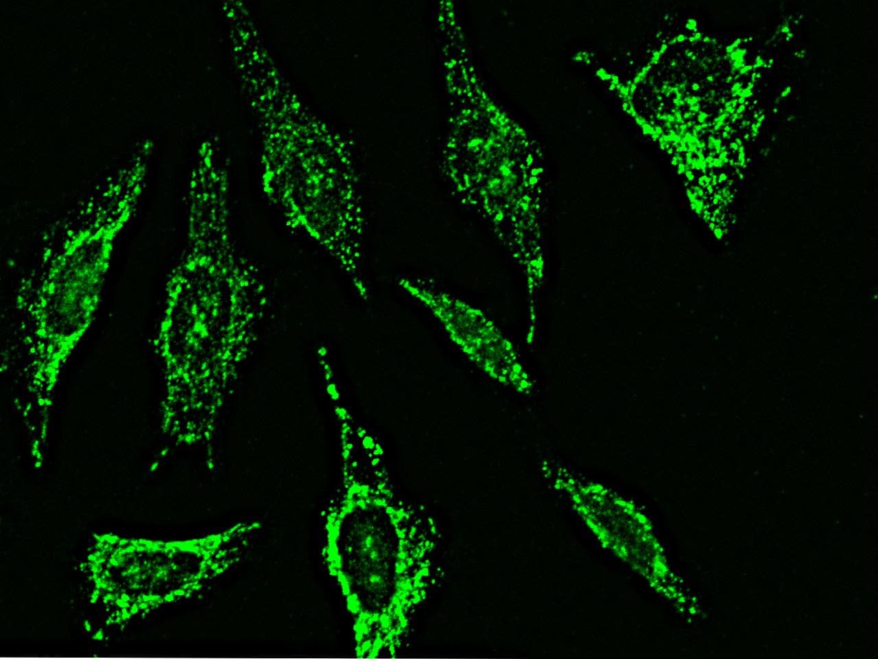 Polyclonal Rabbit anti-Human MMP26 Antibody (Preservative Free, IHC, IF)