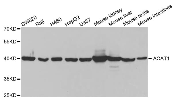Polyclonal Rabbit anti-Human ACAT1 Antibody (IHC, IF, WB)
