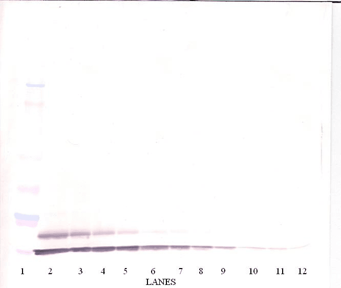 CCL17 / TARC Antibody