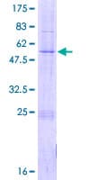 Human TIMM21 Protein (Recombinant GST)