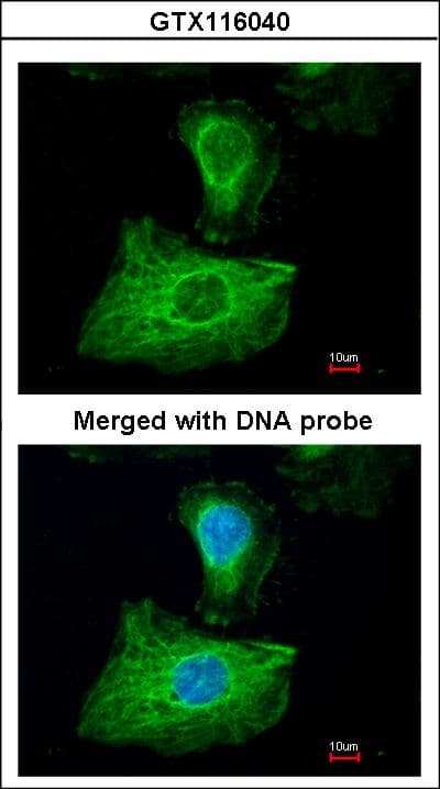 IHC-plus™ GPX1 / Glutathione Peroxidase Antibody