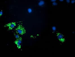 PDHA1 / PDH E1 Alpha Antibody (clone OTI2B10)
