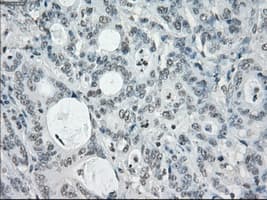 SLC7A8 / LAT2 Antibody (clone OTI7D6)
