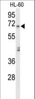 AMY1A / Salivary Amylase Antibody (aa195-223)