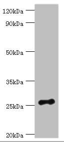 Polyclonal Rabbit anti-Human VAPB Antibody (aa10-222, WB)