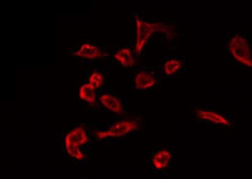 Polyclonal Rabbit anti-Human NTPCR / C1orf57 Antibody (IF, WB)