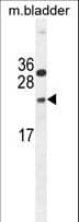 NUDT15 Antibody (aa89-118)