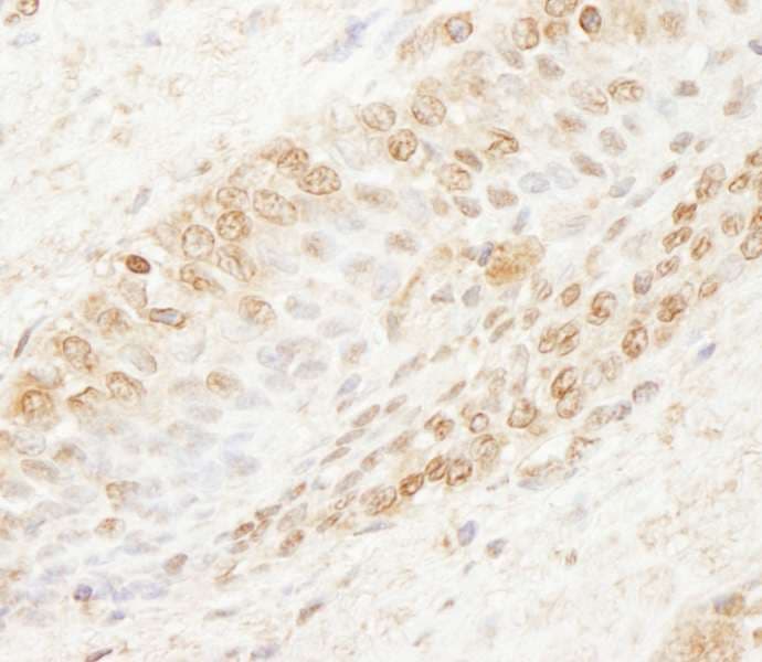 WDR91 Antibody (aa350-400)