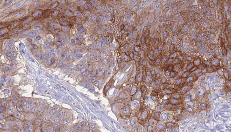 CD66a / CEACAM1 Antibody