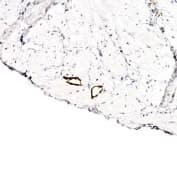 LYVE1 Antibody (C-Terminus, DY488)