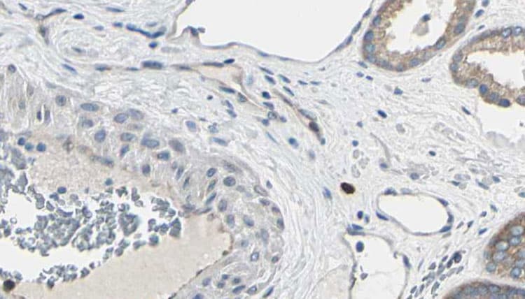Polyclonal Rabbit anti-Human EIF4E Antibody (IHC, IF, WB)
