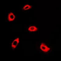 AK4 / Adenylate Kinase 4 Antibody
