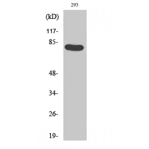 CALD1 / Caldesmon Antibody (730-810 aa)
