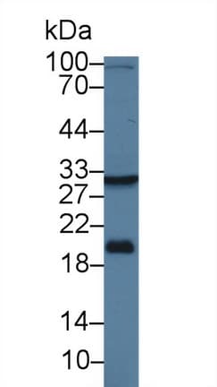 HSD17B12 Antibody (aa1-312)