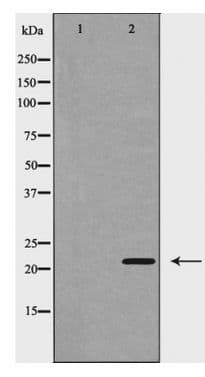 Polyclonal Rabbit anti-Human VEGFB Antibody (IHC, WB)