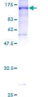 Human CNKSR1 Protein (Recombinant GST)